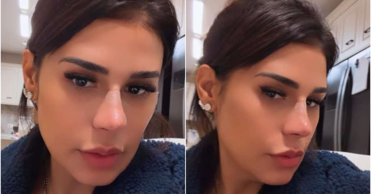 Simone Mendes fez plástica no nariz? Cantora revela procedimento realizado