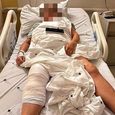O que se sabe sobre caso de mulher que teve prótese implantada no joelho errado após cirurgia no PR