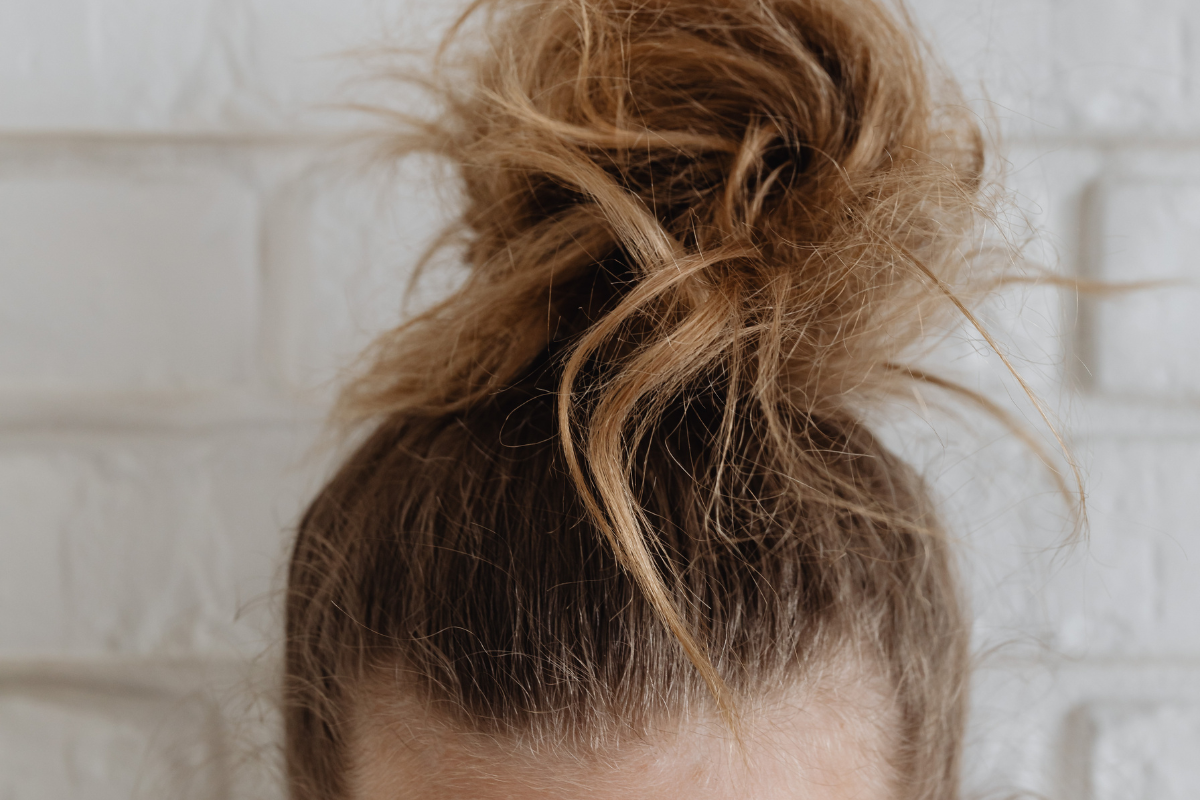 Cabelo áspero e difícil de cuidar? Médicas explicam o que é scab hair