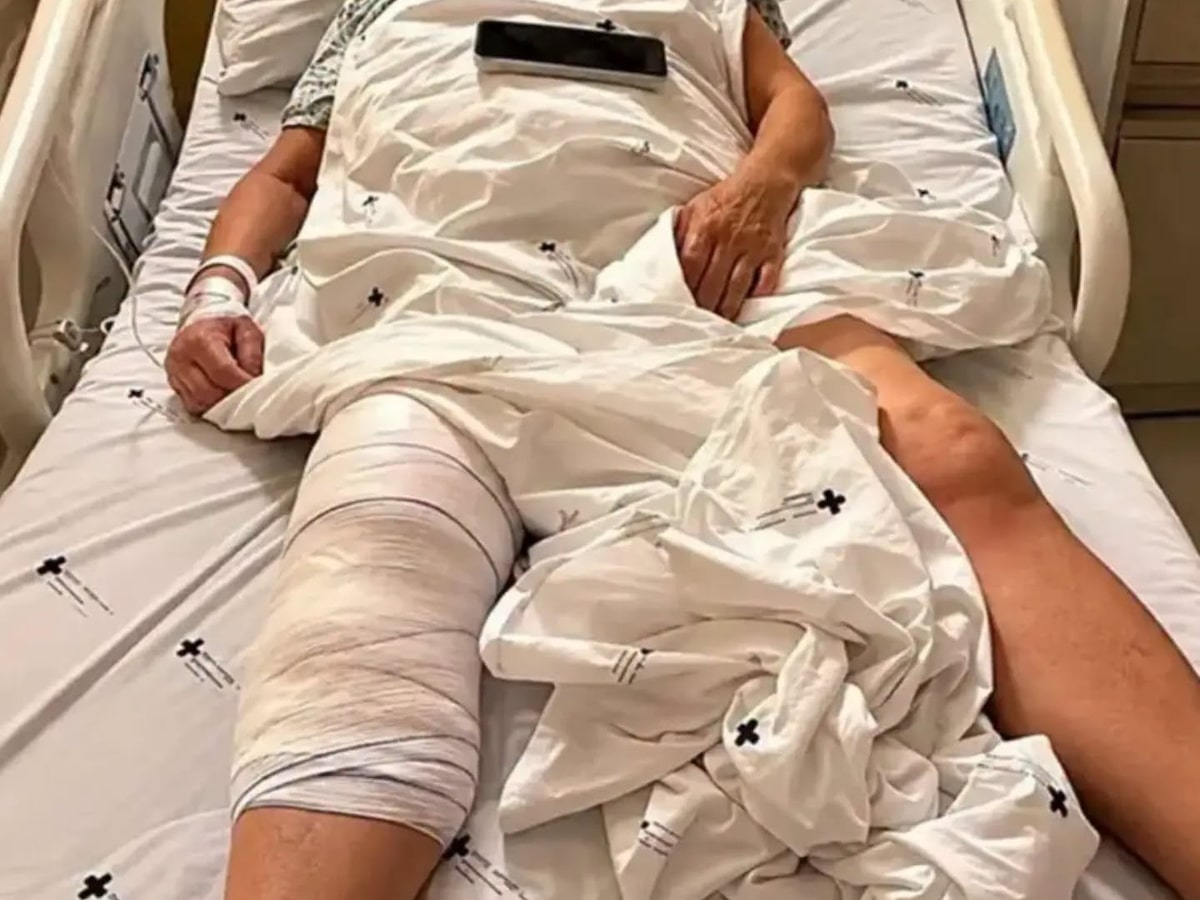 O que se sabe sobre caso de mulher que teve prótese implantada no joelho errado após cirurgia no PR