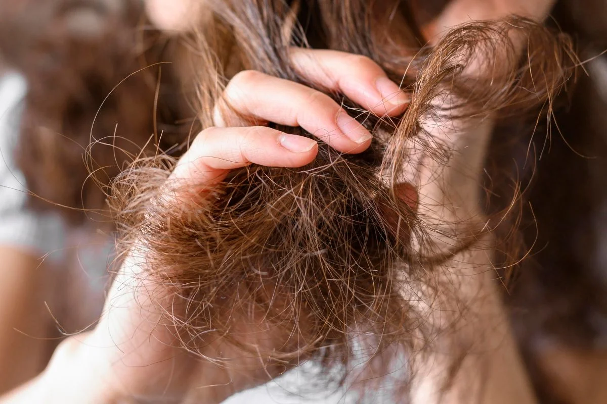 scab hair - Metrópoels