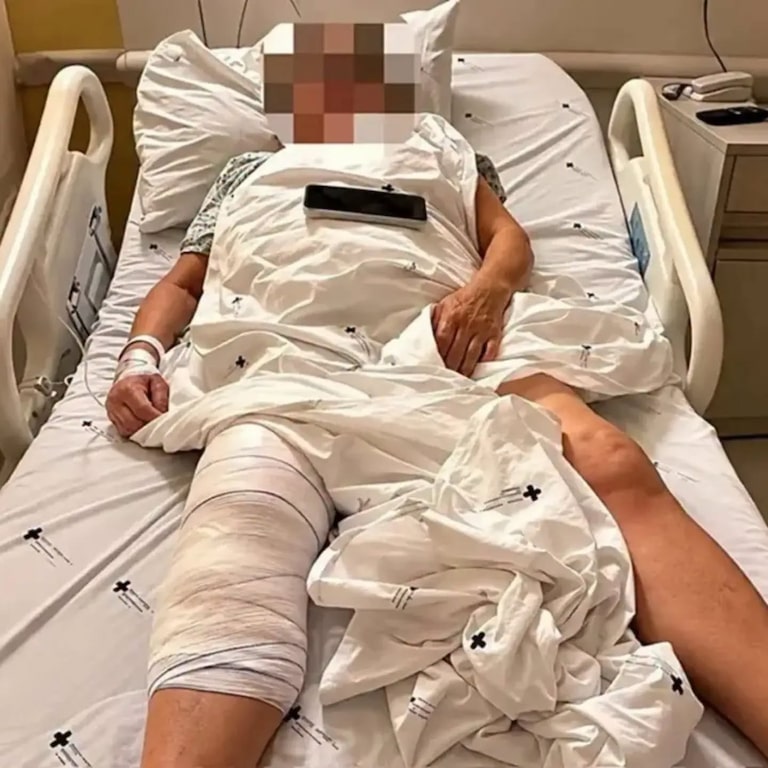 O que se sabe sobre caso de mulher que teve prótese implantada no joelho errado após cirurgia no PR